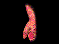 男性功能性阳痿的原因有哪些? 男性功能性阳痿的原因有哪些?